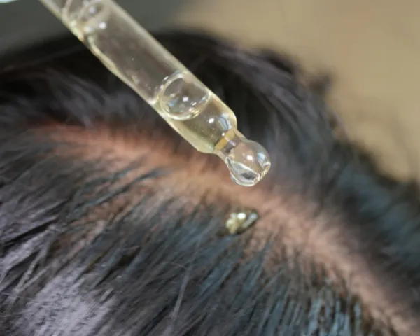 Professional Hair Scalp Treatment in Navalur at Tula Unisex Salon and Spa